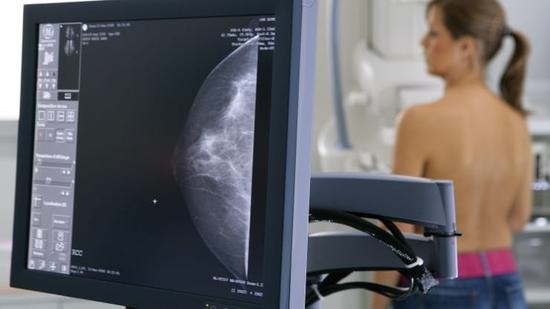 经历2.9万名女性乳房X光图片训练，谷歌DeepMind在乳腺癌筛查试验中击败医生