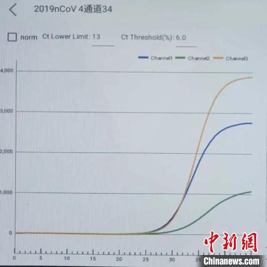 浙江研发新冠病毒抗体快速检测试剂盒 最快只需2分钟