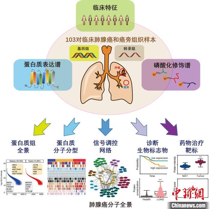 中国科学家首次揭示肺腺癌分子全景