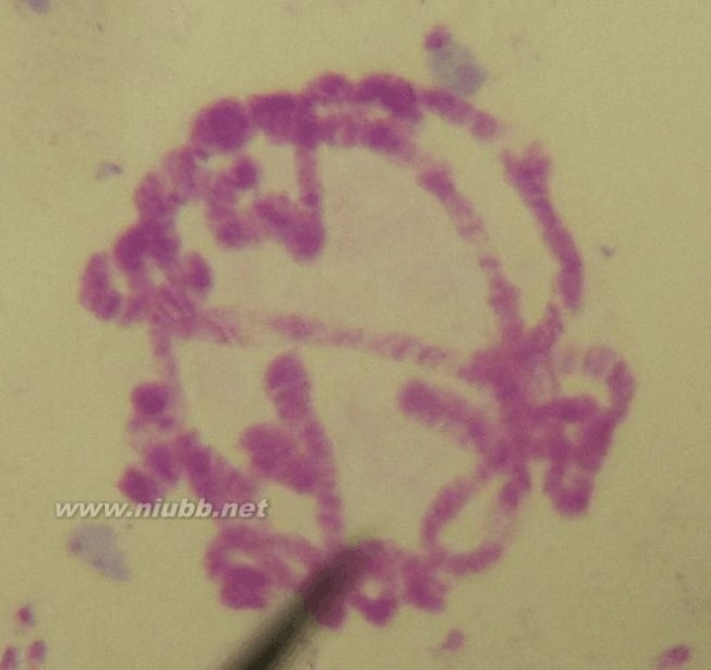 果蝇唾腺染色体 果蝇唾液腺染色体标本的制备与观察