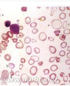 红细胞：红细胞-基本介绍，红细胞-种类介绍_红细胞的作用