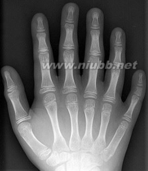 第五世界 六根手指的外星人