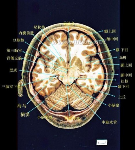 顶叶属于什么中枢 大脑各叶分界标志（三沟五叶）