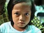 印度尼西亚割礼 印度尼西亚 残忍女性割礼习俗