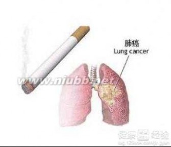 得了肺癌怎么治疗 老年人得了肺癌怎么办？