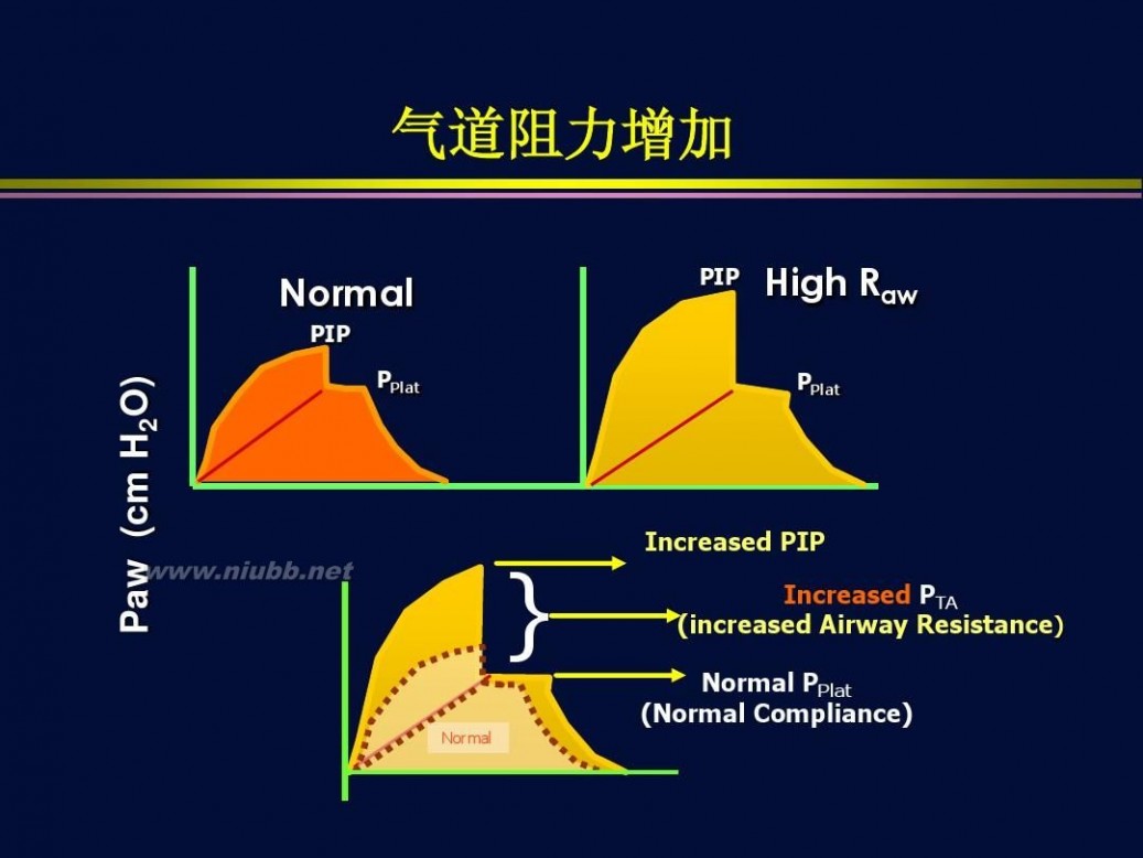 杜斌 杜斌_机械通气