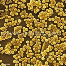 金黄色葡萄球菌：金黄色葡萄球菌-简介，金黄色葡萄球菌-流行病学_金黄色葡萄球菌