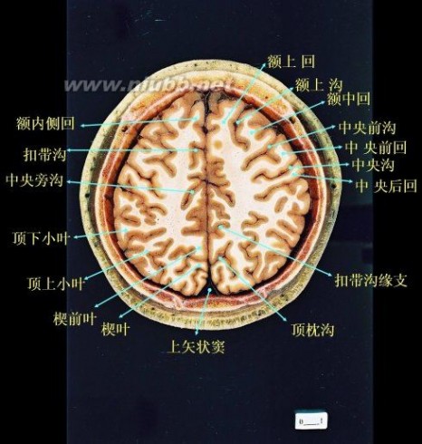 顶叶属于什么中枢 大脑各叶分界标志（三沟五叶）