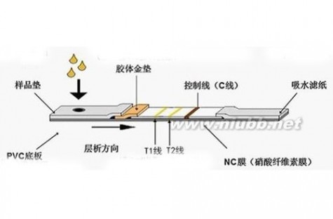 艾滋病自我检测方法_艾滋自我检测