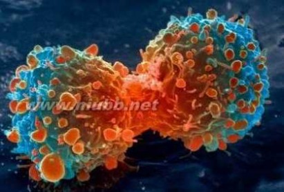 杀癌细胞病毒 美国科学院院报讯：发现抗癌病毒 杀癌细胞对正常