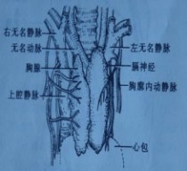 胸腺癌 胸腺癌的诊断和治疗