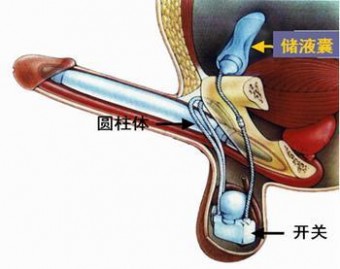  伟哥效果图 吃了伟哥后的效果图 吃了伟哥会怎么样