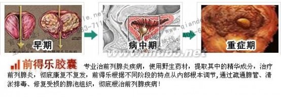 尿等待是什么意思？