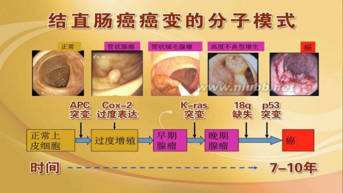 2015年6月8日播出《难以察觉的致命息肉》