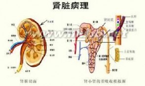 过敏性紫癜性肾炎：过敏性紫癜性肾炎-诊断标准，过敏性紫癜性肾炎-病因及发病机理_过敏性紫癜肾