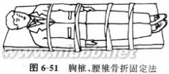 骨折：骨折-概述，骨折-骨折分类_开放性骨折