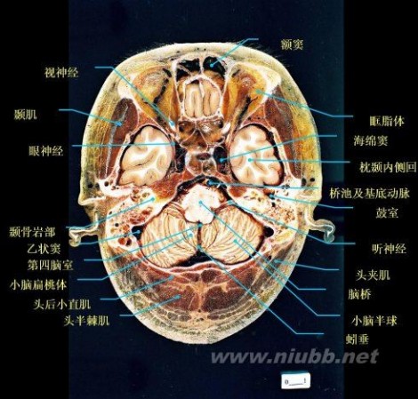 顶叶属于什么中枢 大脑各叶分界标志（三沟五叶）