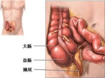 阑尾炎的症状 阑尾炎的常见症状是什么