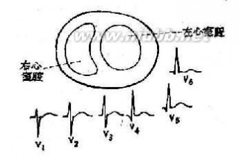 心电图导联位置 心电图导联及心电轴