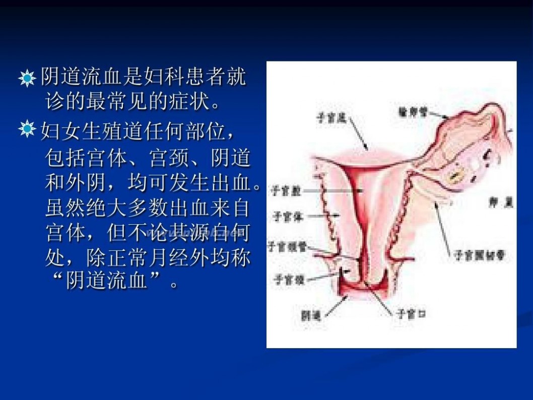 妇科流血 妇科阴道流血的相关疾病