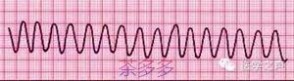 如何看心电图 简简单单，看懂心电图 （入门）
