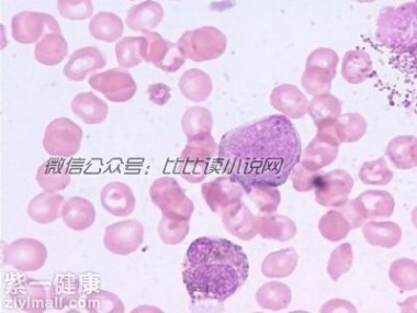 白血球高是怎么回事 白细胞高是什么原因 【警惕】体内出现感染炎症