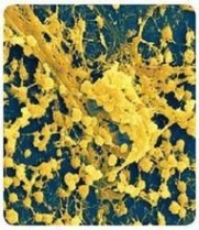 金黄色葡萄球菌：金黄色葡萄球菌-简介，金黄色葡萄球菌-流行病学_金黄色葡萄球菌