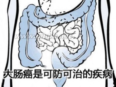 辛辣食物有哪些 大肠癌饮食忌辛辣食物