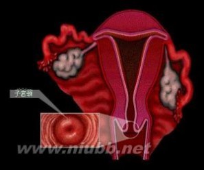 卵巢疾病：卵巢疾病-卵巢疾病分类：，卵巢疾病-常见卵巢疾病解析_卵巢疾病