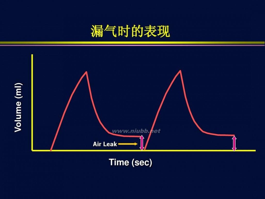 杜斌 杜斌_机械通气