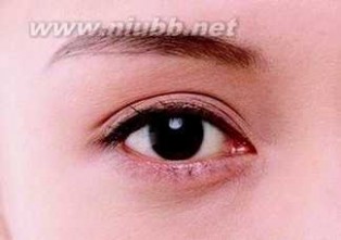 青光眼的症状 青光眼有什么症状保护视力从生活细节做起