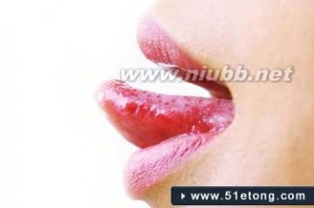舌头发干 舌头发干怎么办 从舌头状态看健康