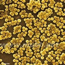 金黄色葡萄球菌：金黄色葡萄球菌-简介，金黄色葡萄球菌-流行病学_金色葡萄球菌